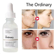 The Ordinary Niacinamide 10% + Zinc 1% Face Serum  ( Canada Imported )